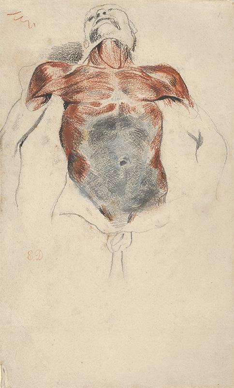 Ecorché Torso of a Male Cadaver